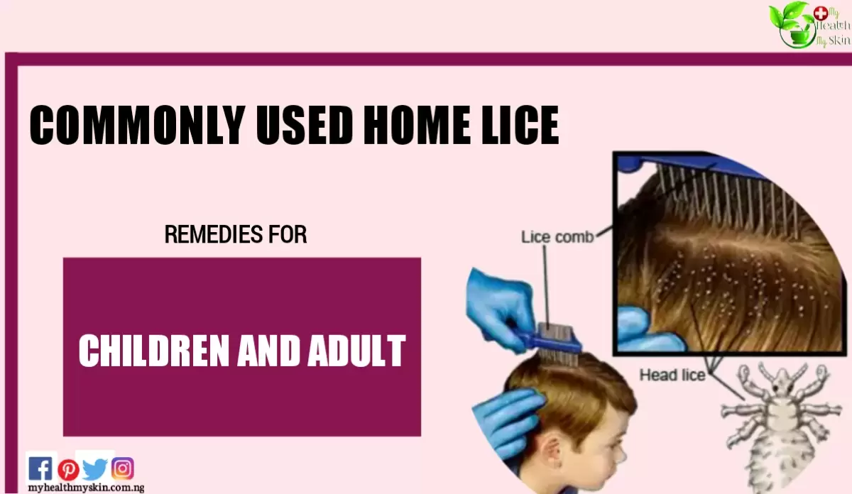 Commonly Used Home Lice Remedies for Children and Adult