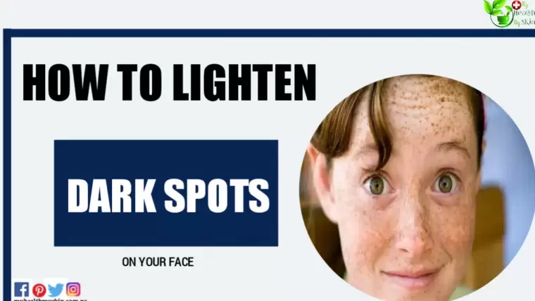 How To Lighten Dark Spots On Your Face