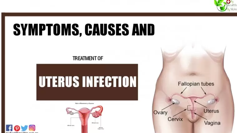 Uterus Infection: Symptoms, Causes and Treatment
