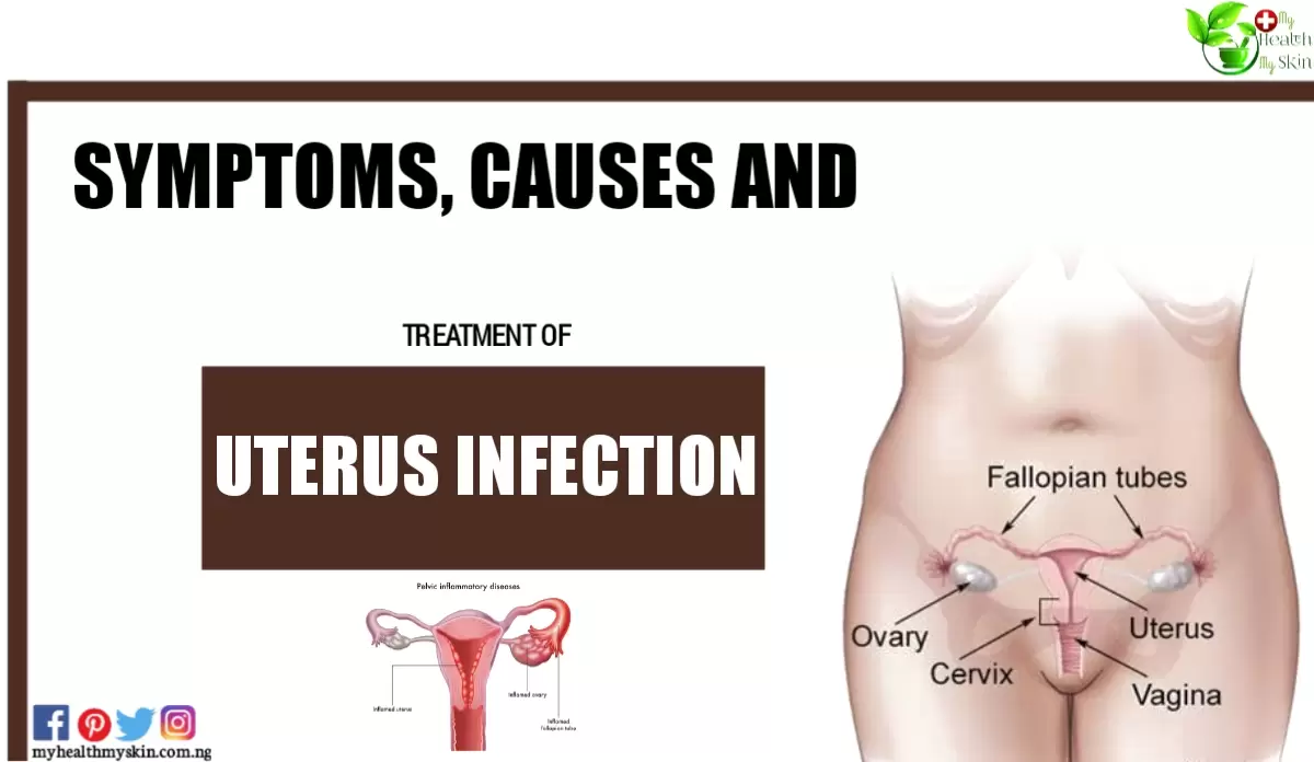 Uterus Infection Symptoms Causes and Treatment
