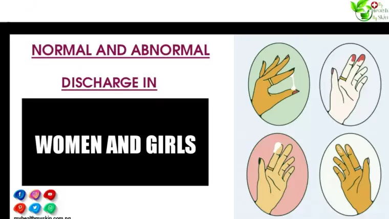 Normal And Abnormal Discharge In Women & Girls