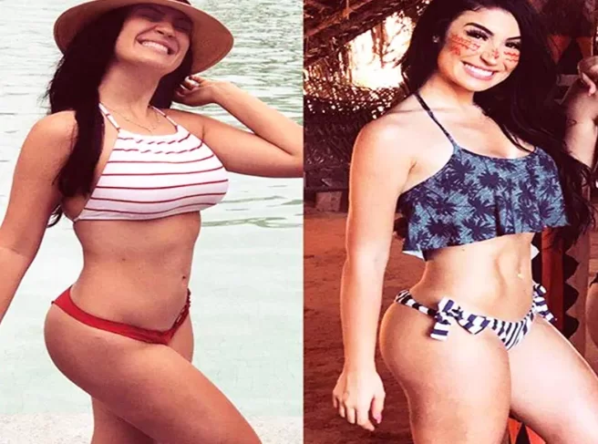 Bianca Andrade had lipo
