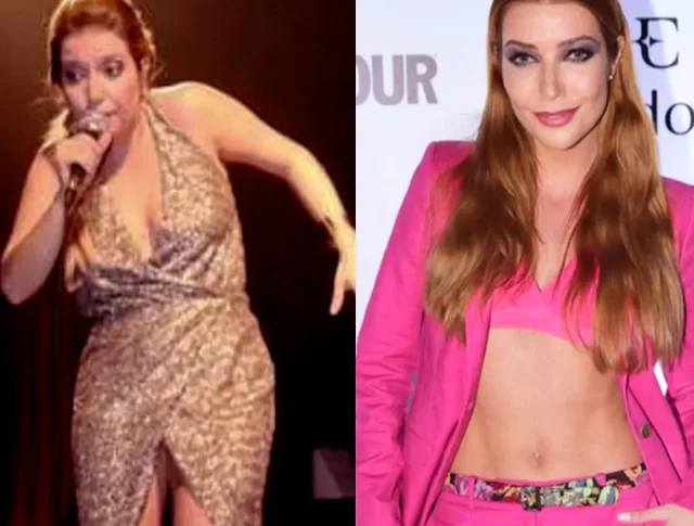 Did Luiza Possi have lipo!