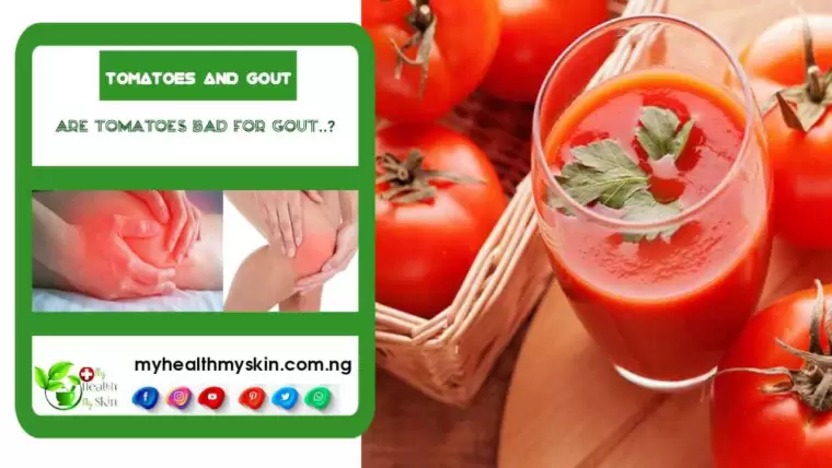 Tomatoes and Gout