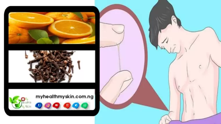 How to Cure Gonorrhea Without Going to the Doctor